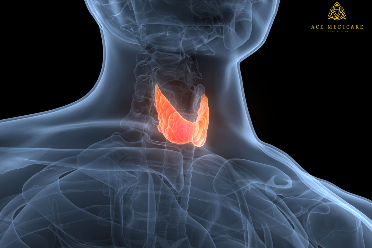 The Impact of Stress on Thyroid Health: Tips for Managing Stress Levels